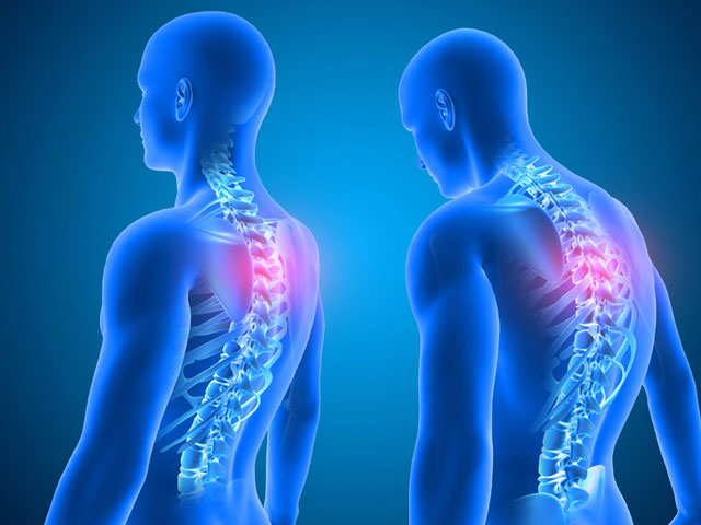 What is Posture Disorder?