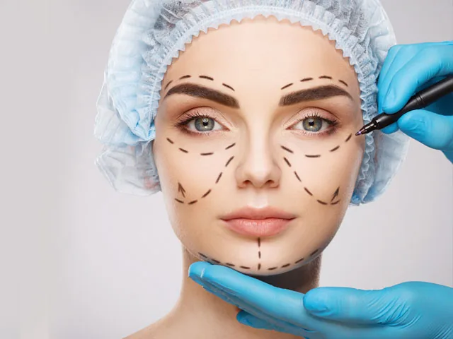 CHIRURGIE PLASTICA