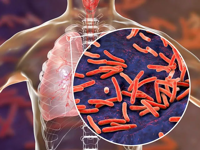 What is Tuberculosis?