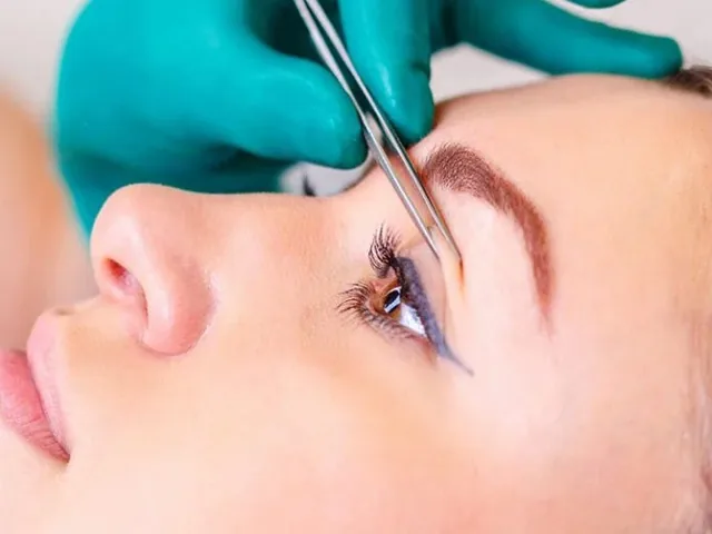 What is Eyelid Aesthetics