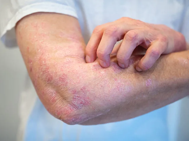 What is Skin Allergy